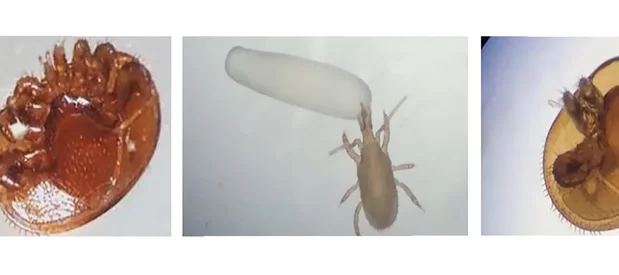 L'acarien Stratiolaelaps scimitus blanc ou beige attaquant un varroa mort à gauche, un oeuf d'abeille au centre et un Varroa destructor blessé à droite.